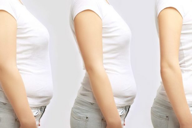 obesity-treatments-or-sports-—-what-matters-more-in-the-fight-against-weight-gain?